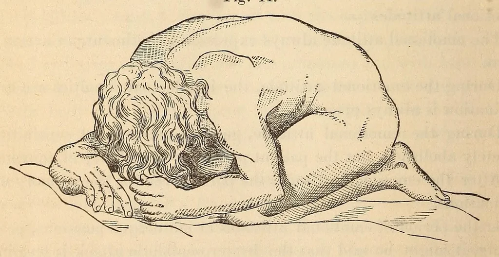 An illustration from The American journal of the medical sciences, 1827, leaf 412
