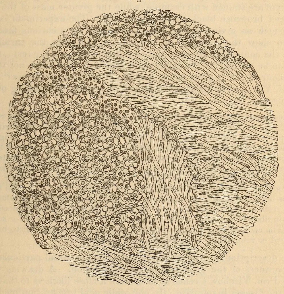 An illustration from The American journal of the medical sciences, 1827, leaf 435