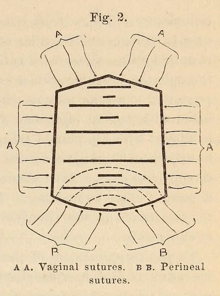 An illustration from The American journal of the medical sciences, 1827, leaf 51