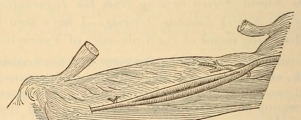 An illustration from The American journal of the medical sciences, 1827, leaf 142
