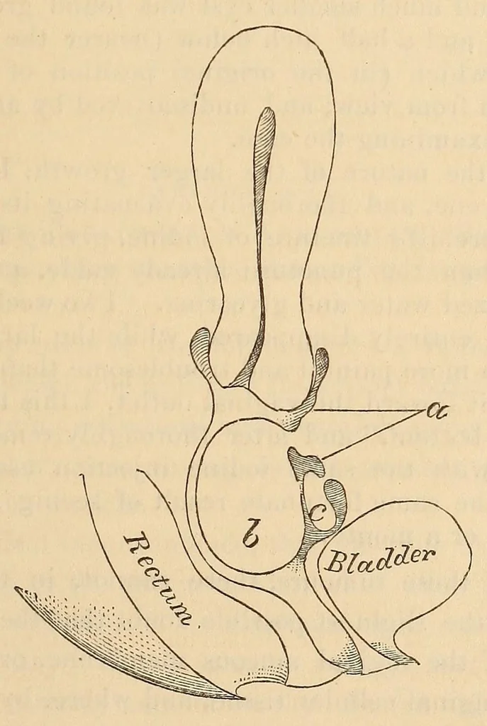 An illustration from The American journal of the medical sciences, 1827, leaf 433
