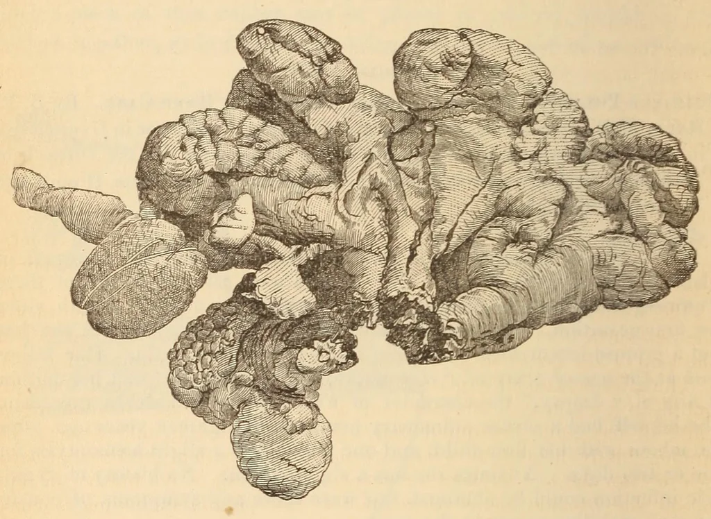 An illustration from The American journal of the medical sciences, 1827, leaf 438