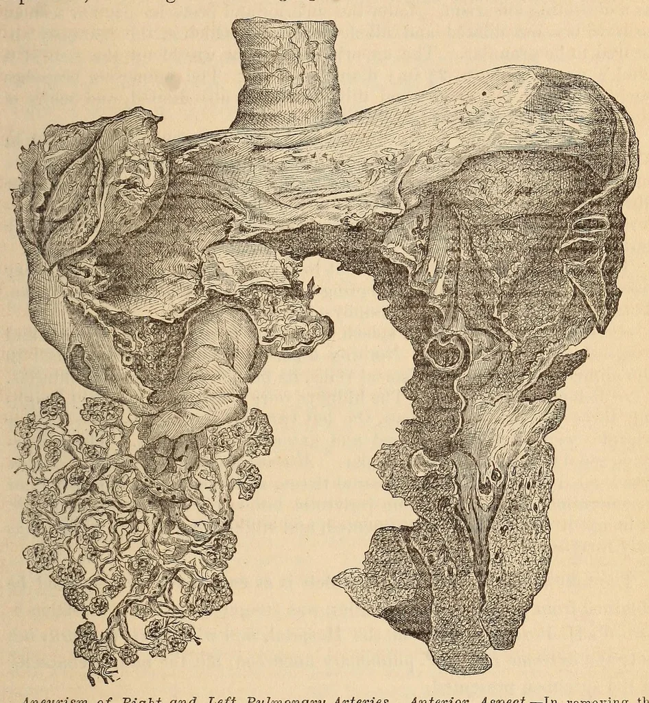 An illustration from The American journal of the medical sciences, 1827, leaf 81