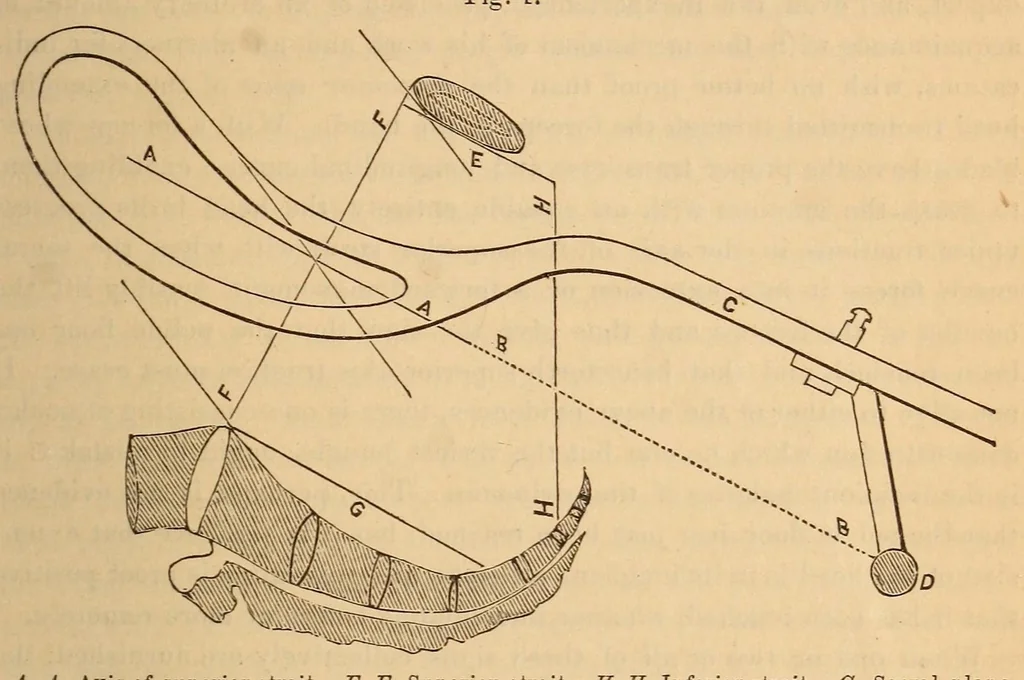 An illustration from The American journal of the medical sciences, 1827, leaf 93