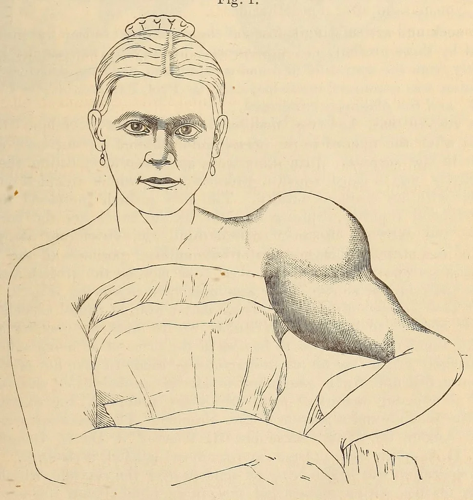 An illustration from The American journal of the medical sciences, 1827, leaf 107