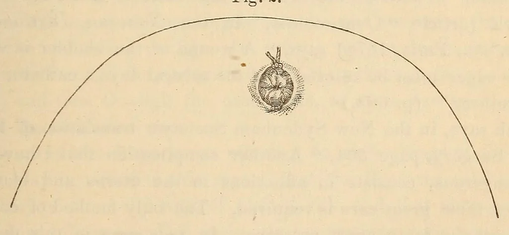 An illustration from The American journal of the medical sciences, 1827, leaf 125