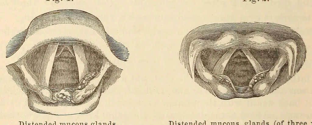 An illustration from The American journal of the medical sciences, 1827, leaf 130