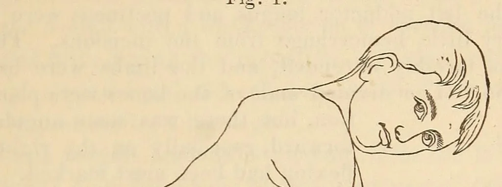 An illustration from The American journal of the medical sciences, 1827, leaf 413