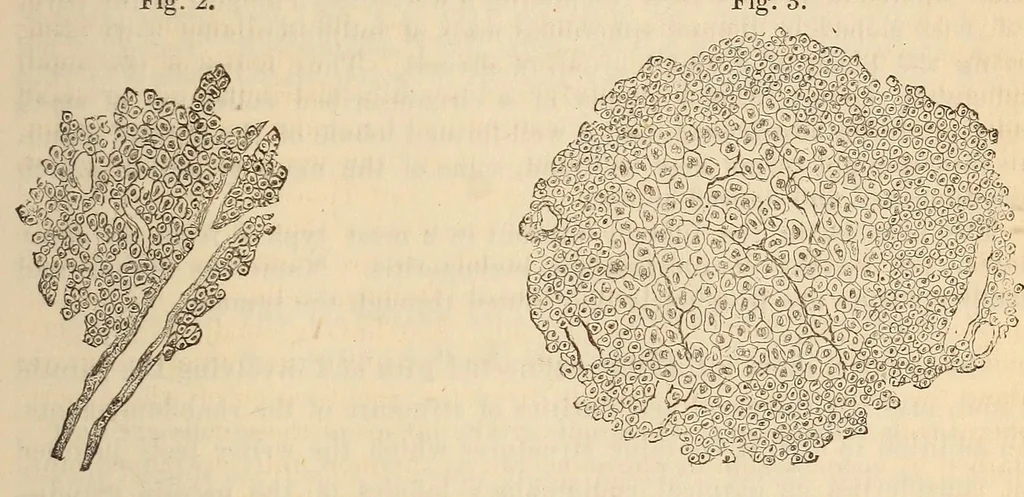 An illustration from The American journal of the medical sciences, 1827, leaf 443