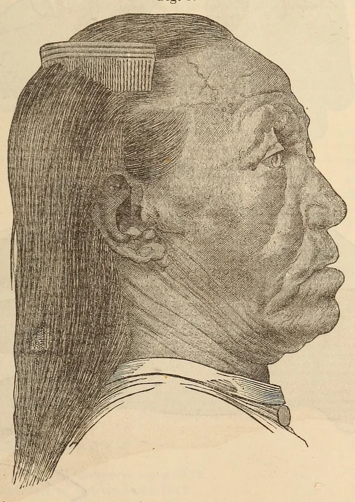 An illustration from The American journal of the medical sciences, 1827, leaf 449