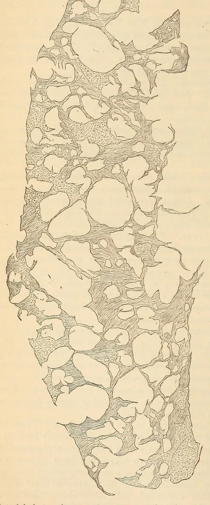 An illustration from The American journal of the medical sciences, 1827, leaf 152