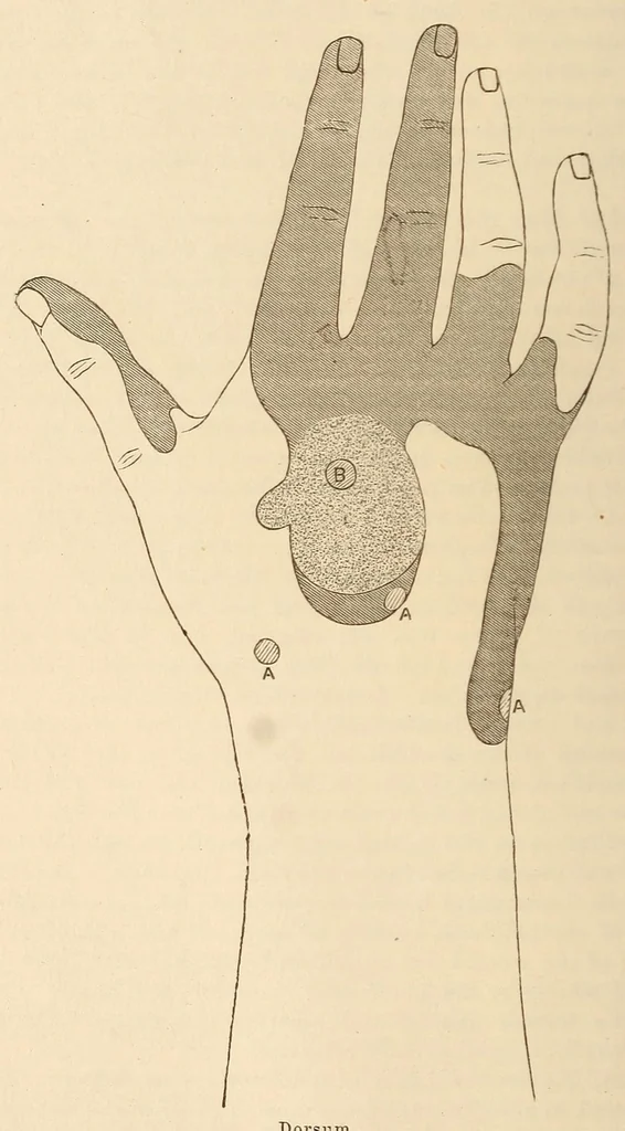 An illustration from The American journal of the medical sciences, 1827, leaf 24
