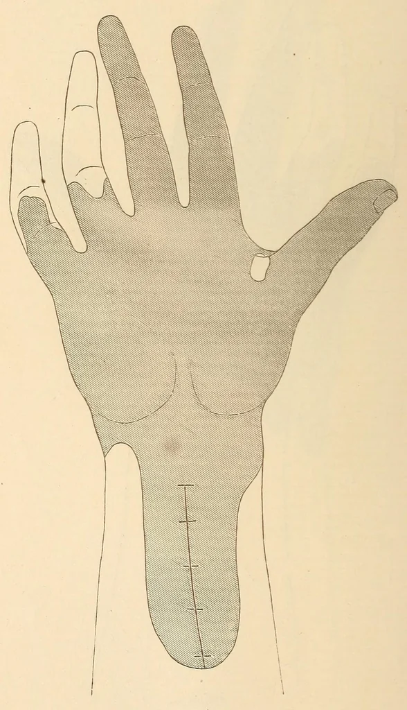 An illustration from The American journal of the medical sciences, 1827, leaf 26