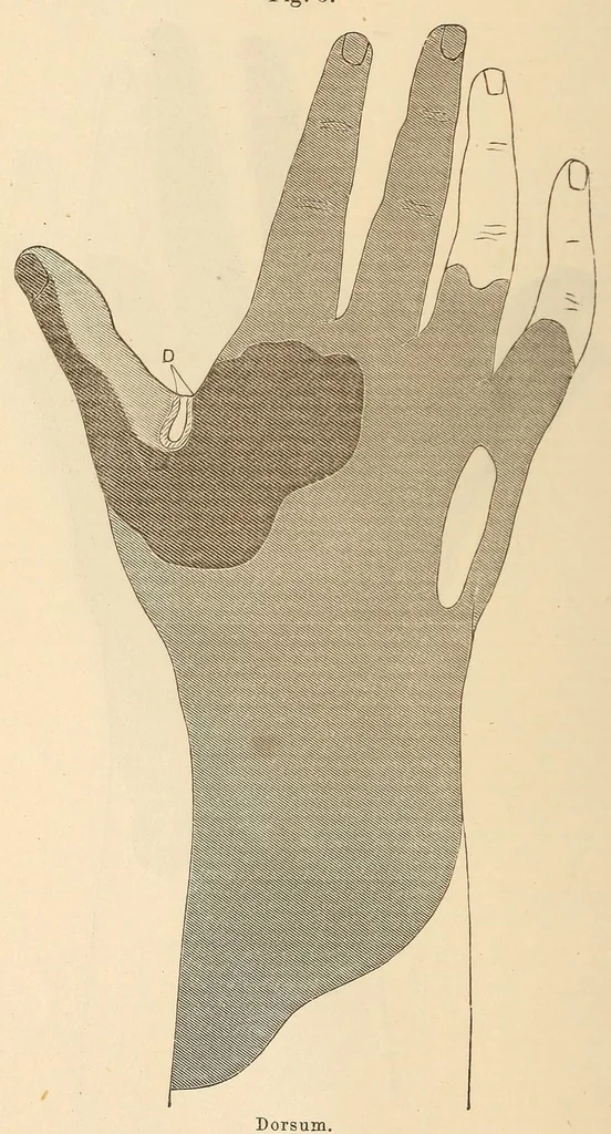 An illustration from The American journal of the medical sciences, 1827, leaf 28