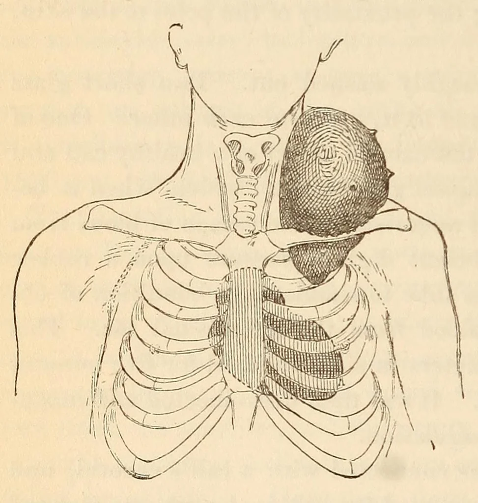 An illustration from The American journal of the medical sciences, 1827, leaf 448