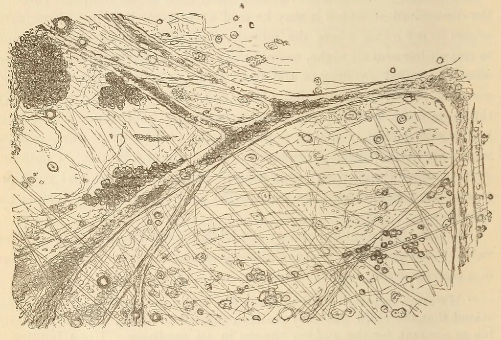 An illustration from The American journal of the medical sciences, 1827, leaf 122