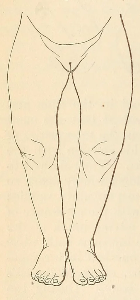 An illustration from The American journal of the medical sciences, 1827, leaf 160