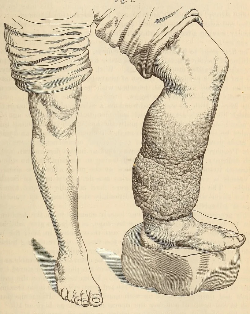 An illustration from The American journal of the medical sciences, 1827, leaf 171