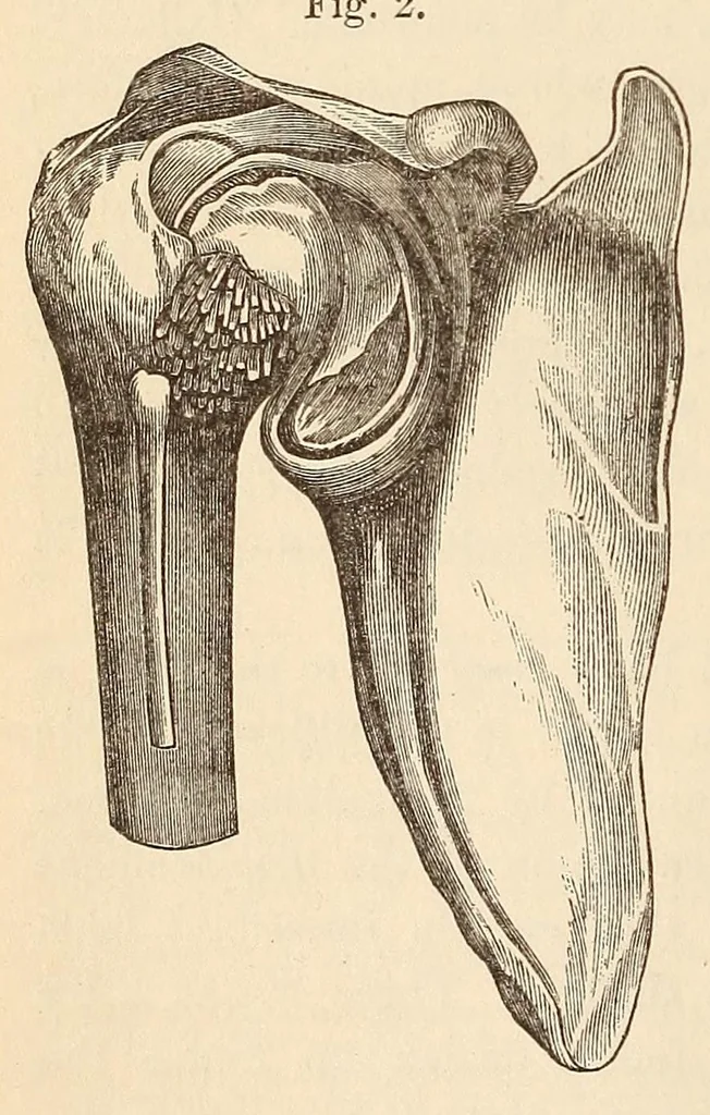 An illustration from The American journal of the medical sciences, 1827, leaf 42