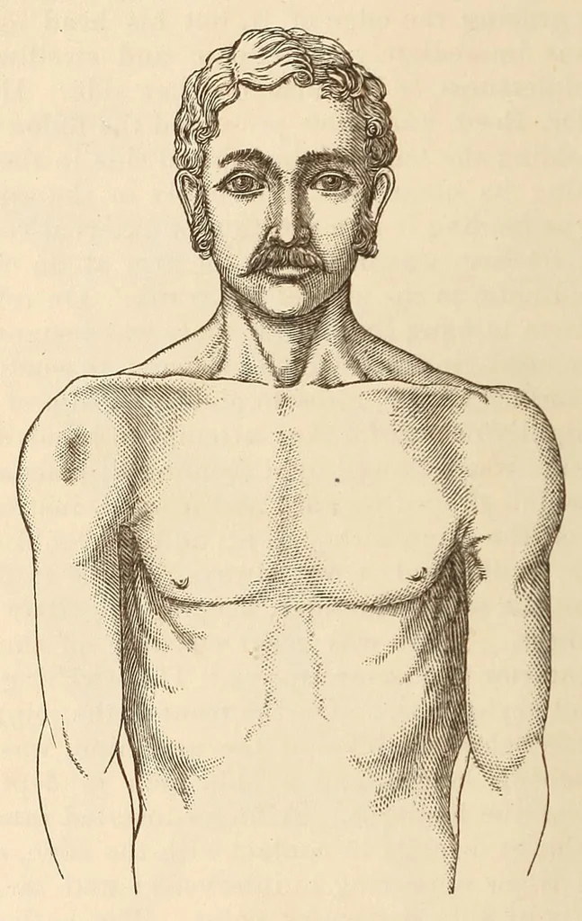 An illustration from The American journal of the medical sciences, 1827, leaf 48
