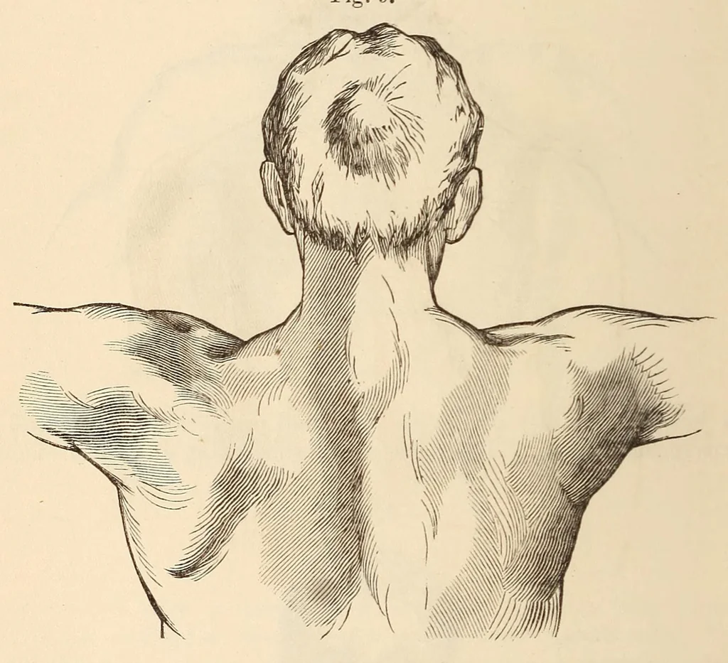 An illustration from The American journal of the medical sciences, 1827, leaf 50