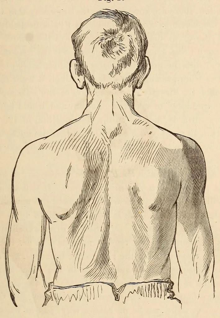 An illustration from The American journal of the medical sciences, 1827, leaf 51