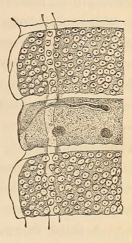 An illustration from The American journal of the medical sciences, 1827, leaf 117