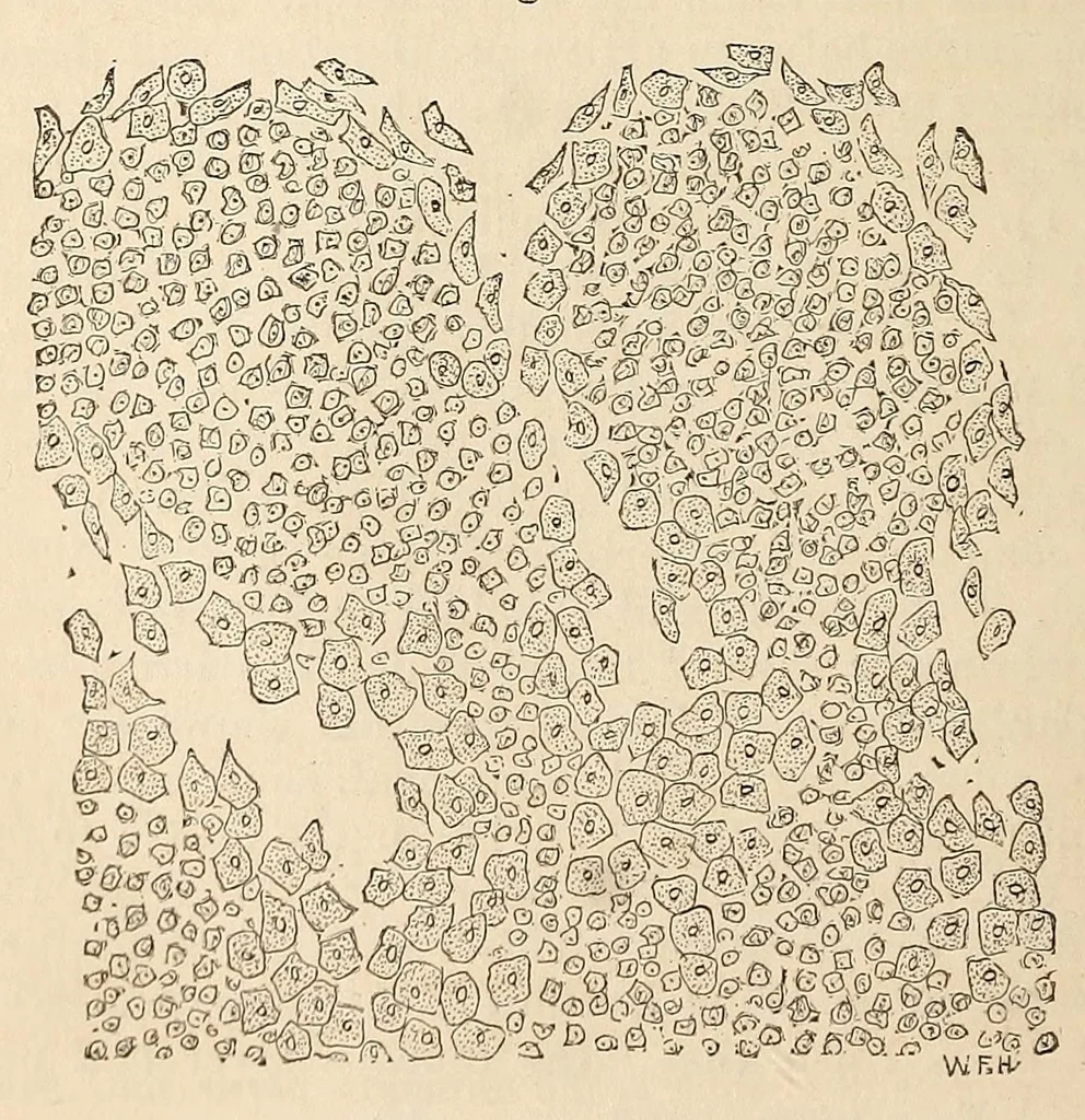 An illustration from The American journal of the medical sciences, 1827, leaf 152