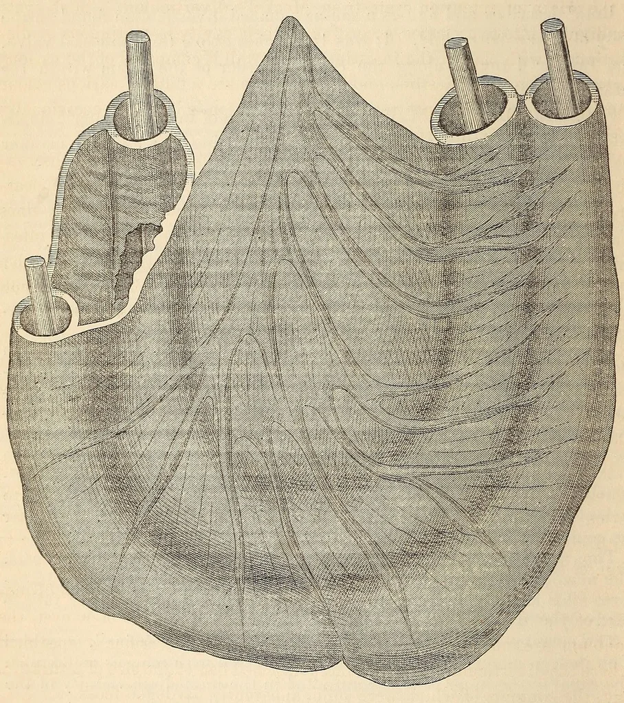 An illustration from The American journal of the medical sciences, 1827, leaf 44