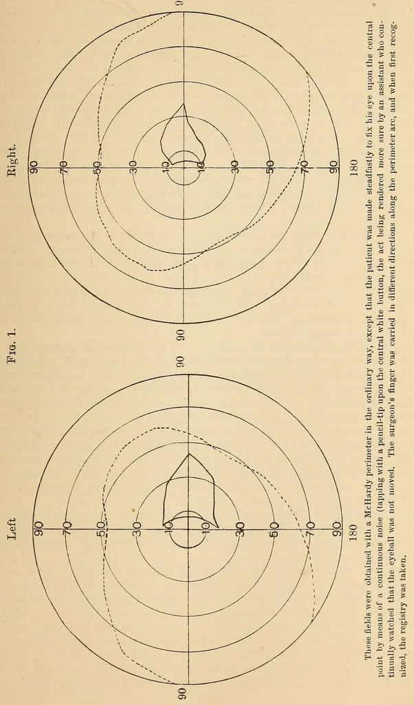 An illustration from The American journal of the medical sciences, 1827, leaf 427