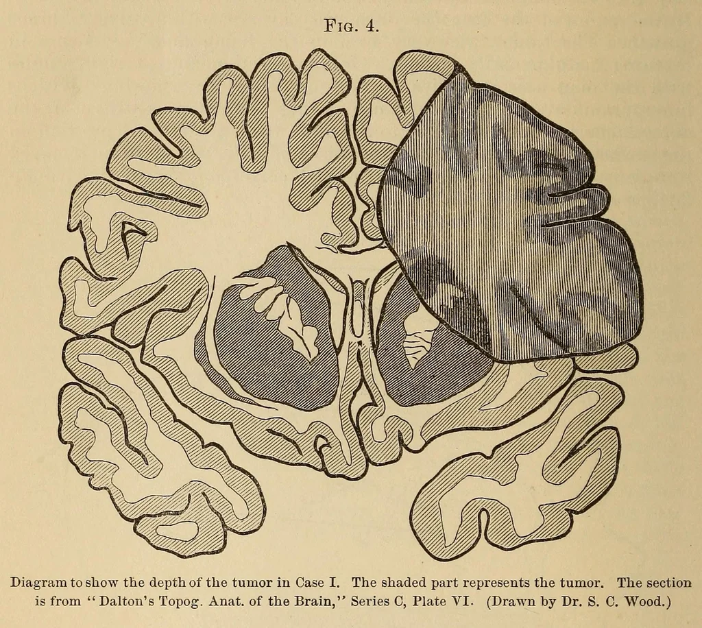 An illustration from The American journal of the medical sciences, 1827, leaf 432