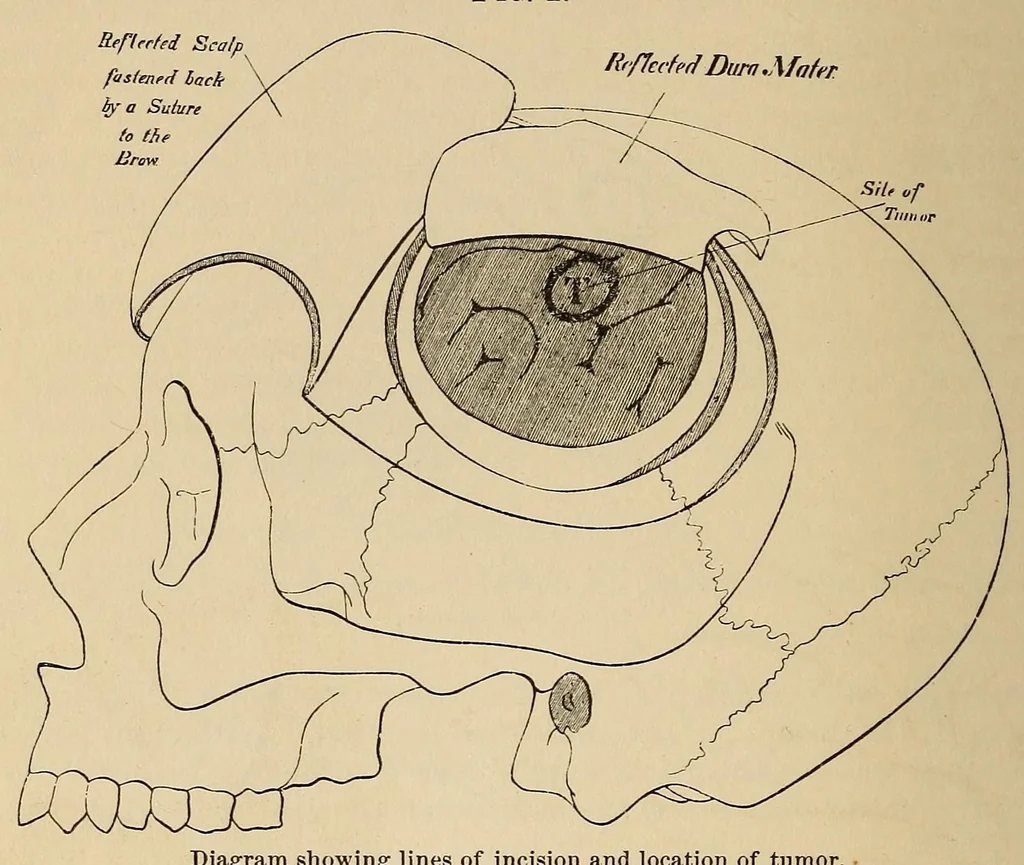 An illustration from The American journal of the medical sciences, 1827, leaf 52