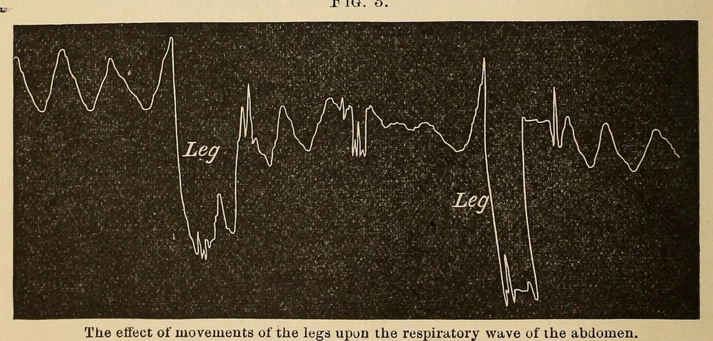 An illustration from The American journal of the medical sciences, 1827, leaf 62