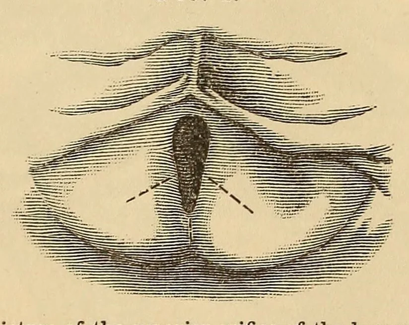 An illustration from The American journal of the medical sciences, 1827, leaf 729