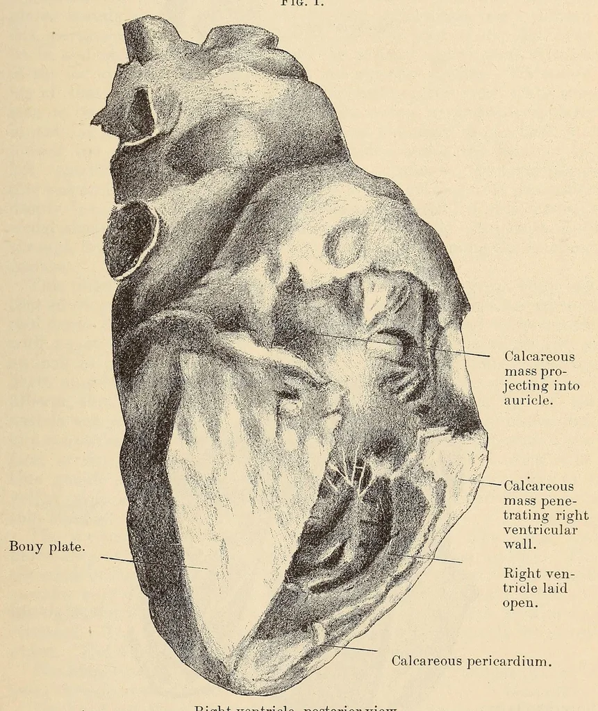 An illustration from The American journal of the medical sciences, 1827, leaf 167