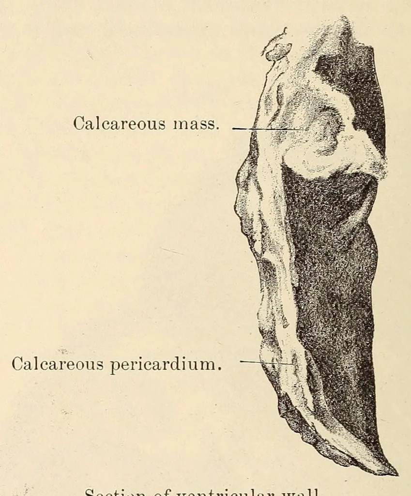 An illustration from The American journal of the medical sciences, 1827, leaf 168