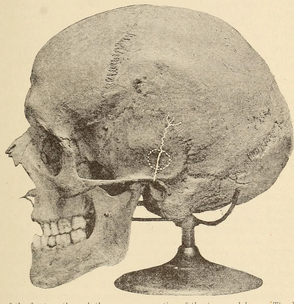 An illustration from The American journal of the medical sciences, 1827, leaf 453