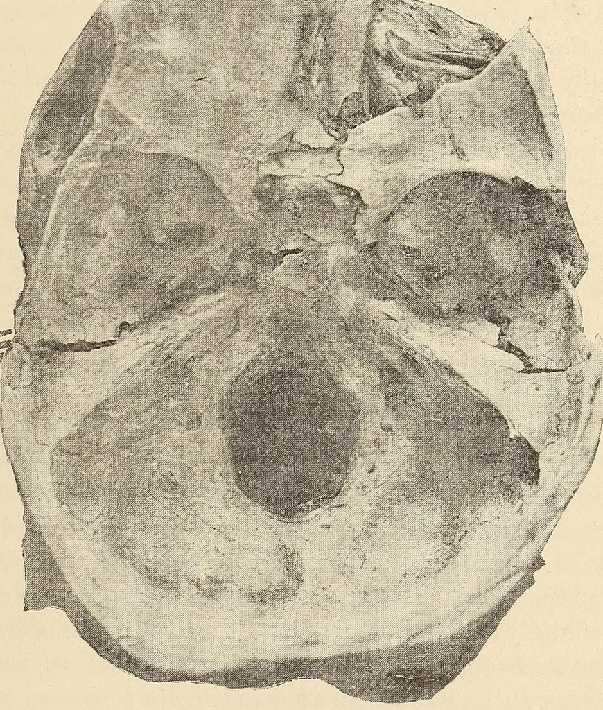 An illustration from The American journal of the medical sciences, 1827, leaf 457