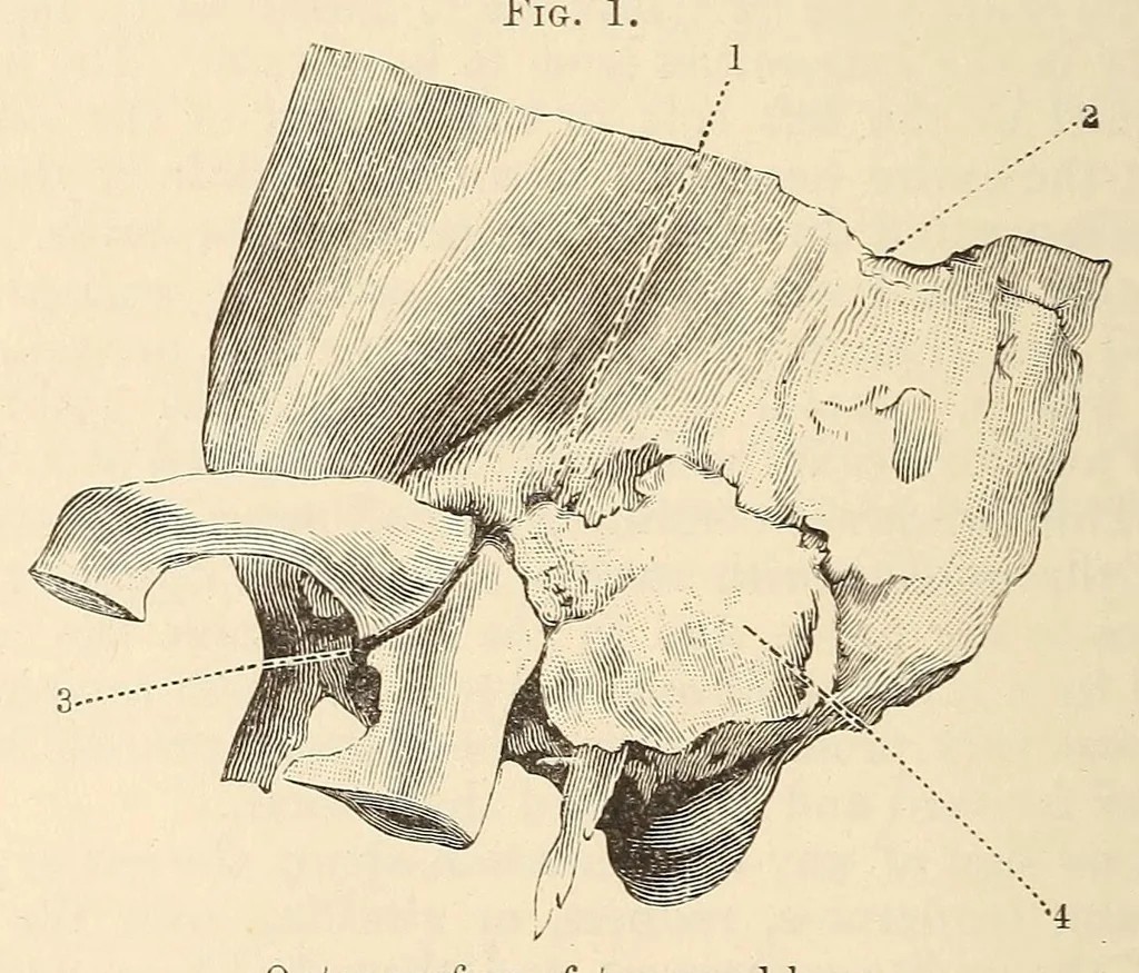 An illustration from The American journal of the medical sciences, 1827, leaf 470
