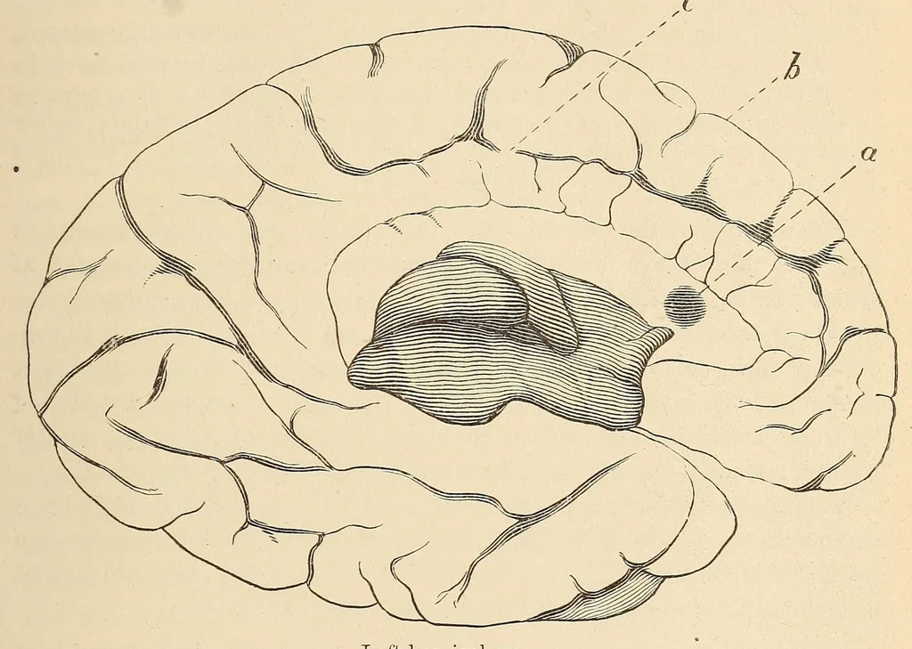 An illustration from The American journal of the medical sciences, 1827, leaf 593