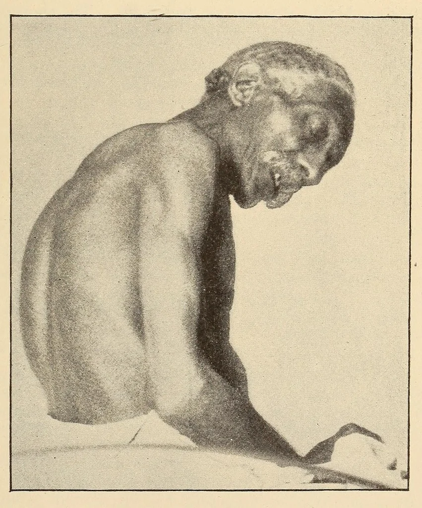 An illustration from The American journal of the medical sciences, 1827, leaf 611