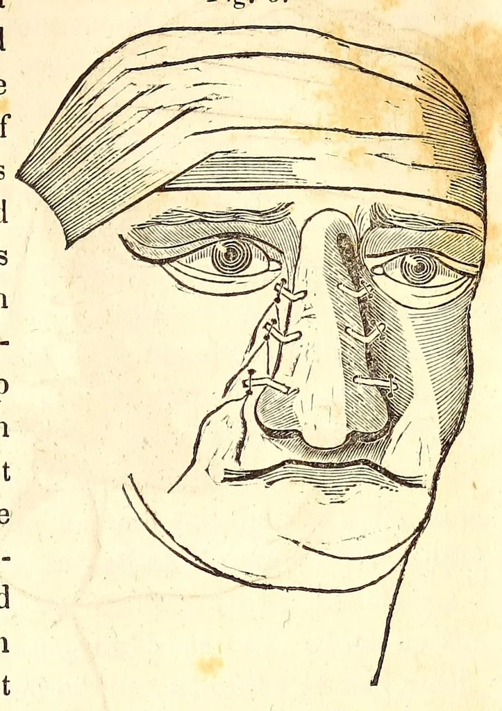 An illustration from The American journal of the medical sciences, 1827, leaf 355