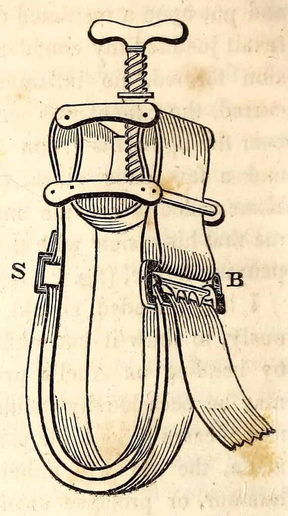 An illustration from The American journal of the medical sciences, 1827, leaf 378