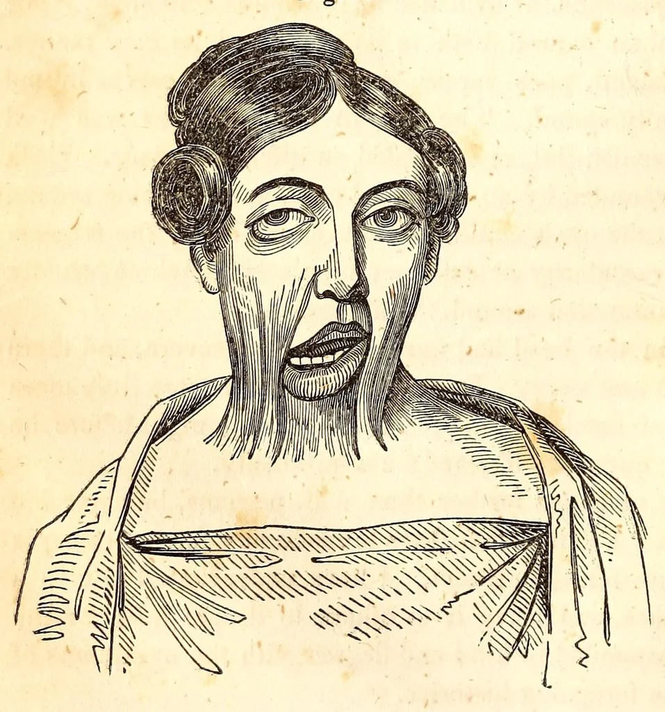 An illustration from The American journal of the medical sciences, 1827, leaf 72