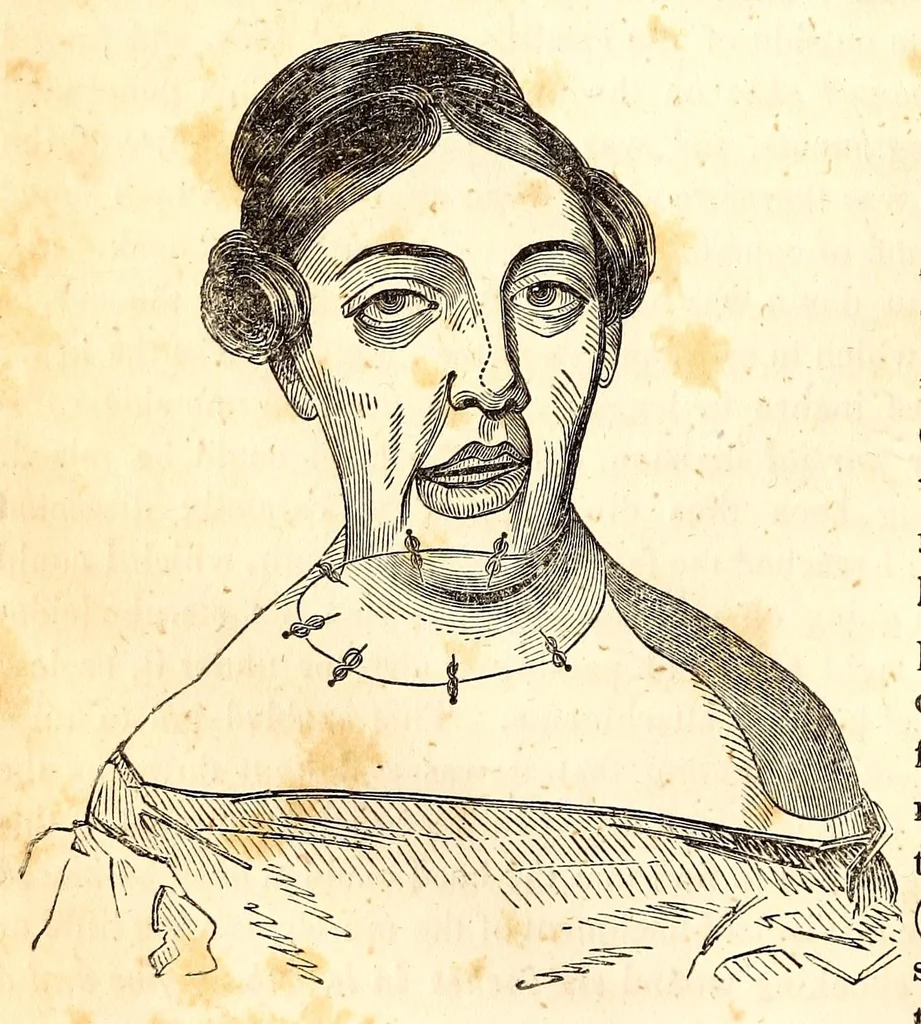 An illustration from The American journal of the medical sciences, 1827, leaf 74
