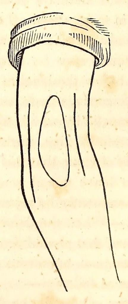 An illustration from The American journal of the medical sciences, 1827, leaf 84