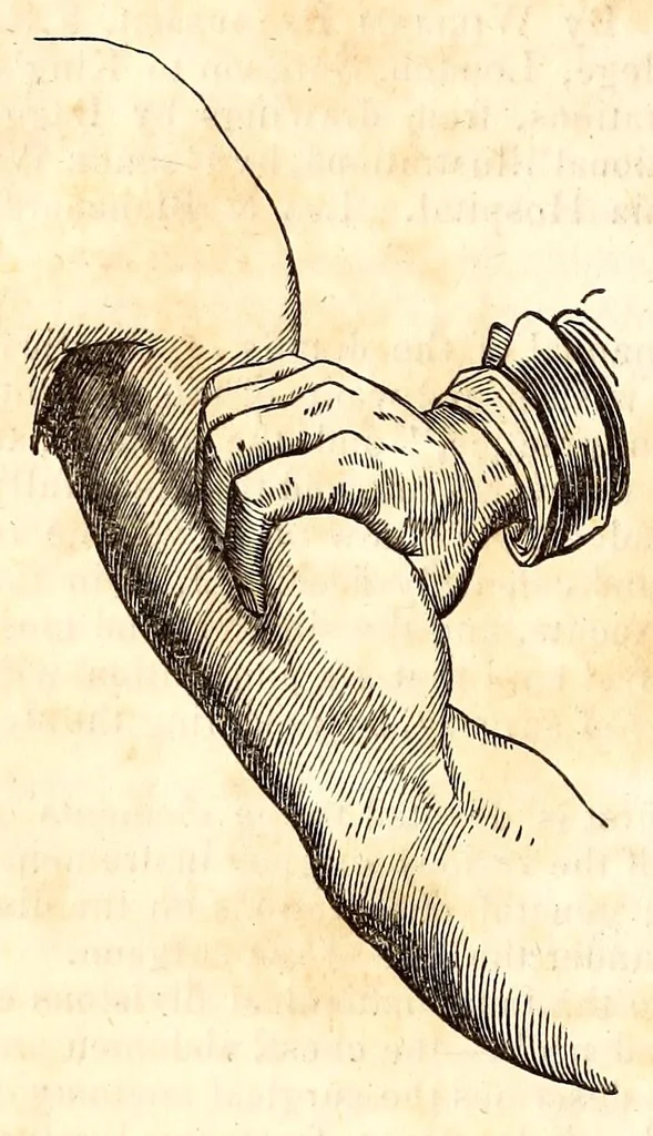 An illustration from The American journal of the medical sciences, 1827, leaf 408