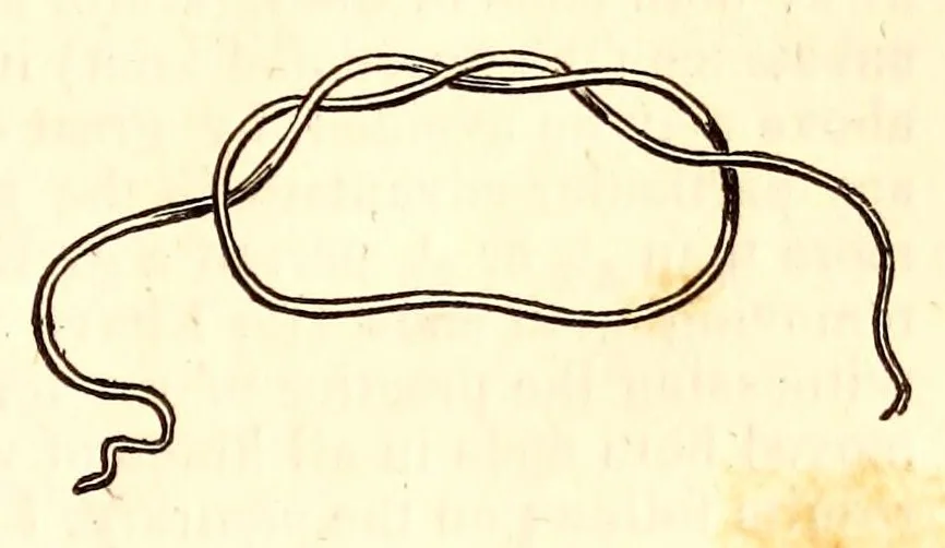 An illustration from The American journal of the medical sciences, 1827, leaf 411