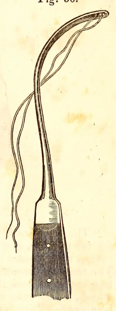 An illustration from The American journal of the medical sciences, 1827, leaf 413