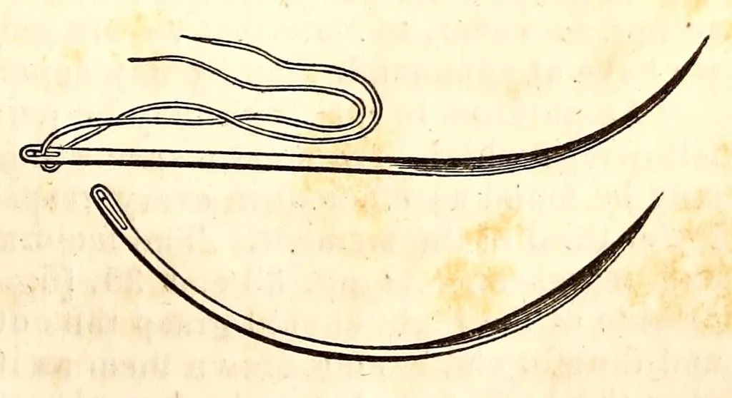 An illustration from The American journal of the medical sciences, 1827, leaf 413
